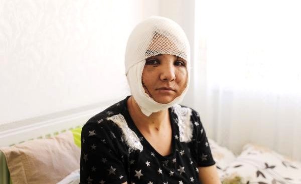 Genç Kadın Kocası Tarafından Boğazından Bıçaklandı