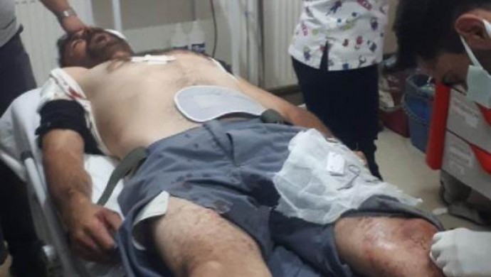 Bahçe duvarı yıkımında patlama: 2 yaralı