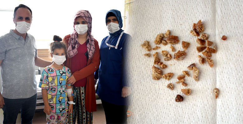 Bu taşlar 8 yaşındaki çocuğun böbreğinden çıktı