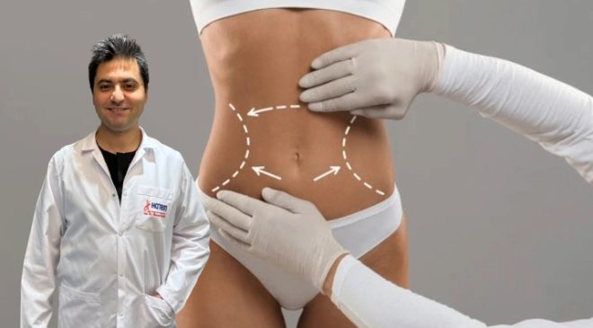 Liposuction Nedir, Ne Değildir? Uzmanından Uyarılar